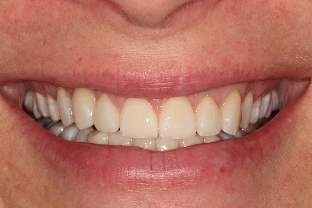 after cosmetic dentistry results by Brad Gorsky, DMD, PC