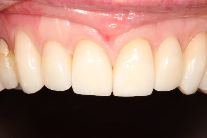 after cosmetic dentistry results by Brad Gorsky, DMD, PC