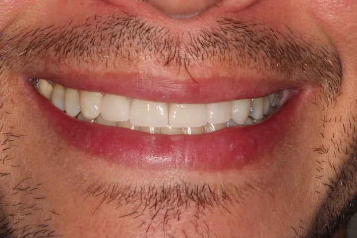 after cosmetic dentistry by Brad Gorsky, DMD, PC