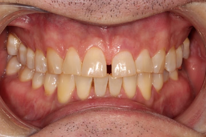 before cosmetic dentistry by Brad Gorsky, DMD, PC